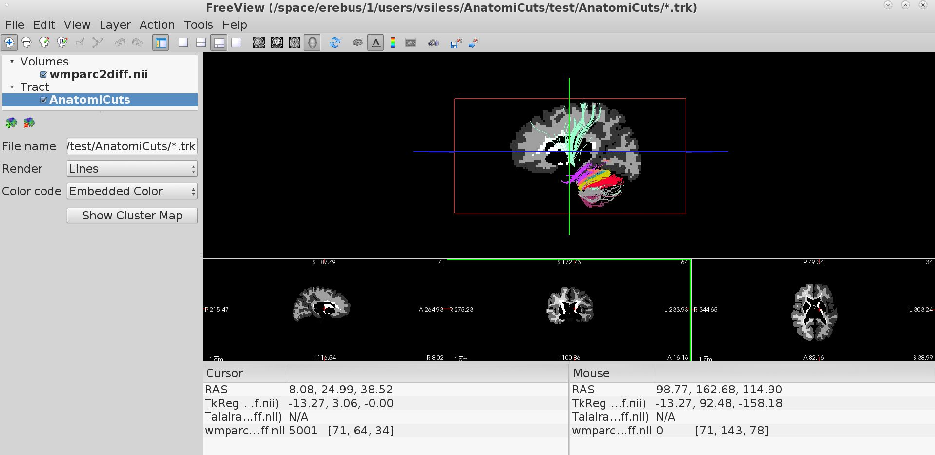 anatomicuts_freeview.png