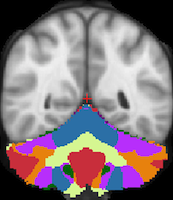 Buckner2011_JNeurophysiol_7networks_LiberalMask_axial.png