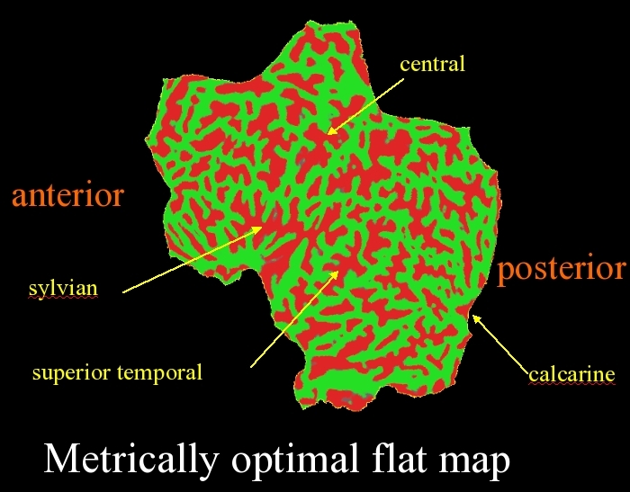 flatwholehemi.jpg