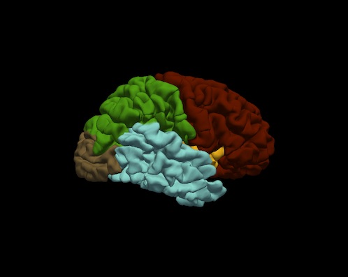 rh.lateral.pial.OAS1_0278_MR1.lobes.jpg