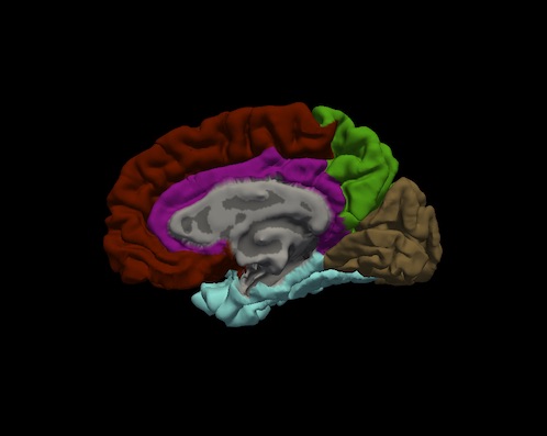 rh.medial.pial.OAS1_0278_MR1.lobes.jpg