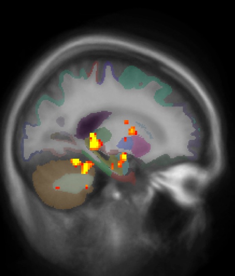 mni.group.encode.sag149.jpg