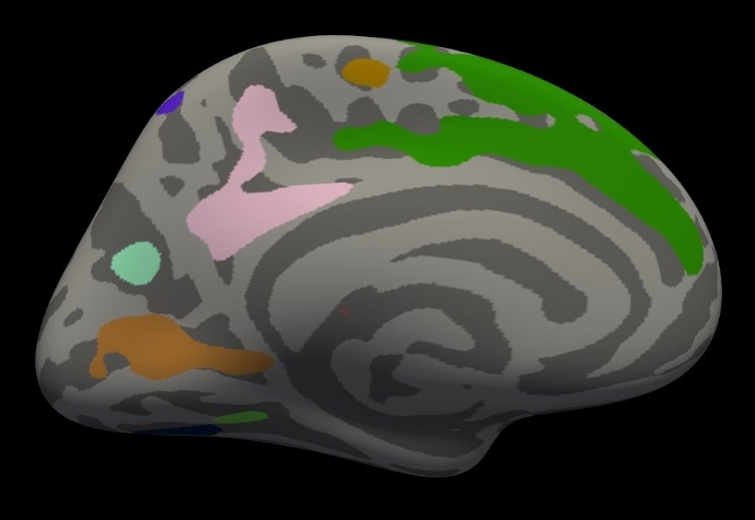 medial_clusters5.3.jpg