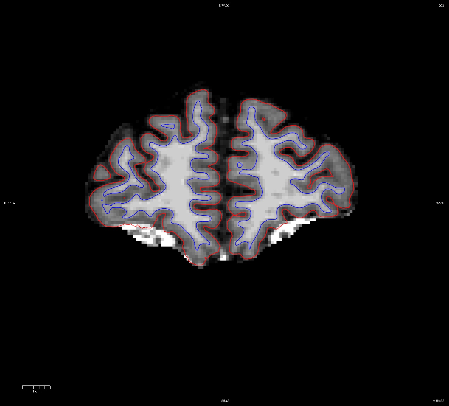 ps_slice_203_base_before.jpg