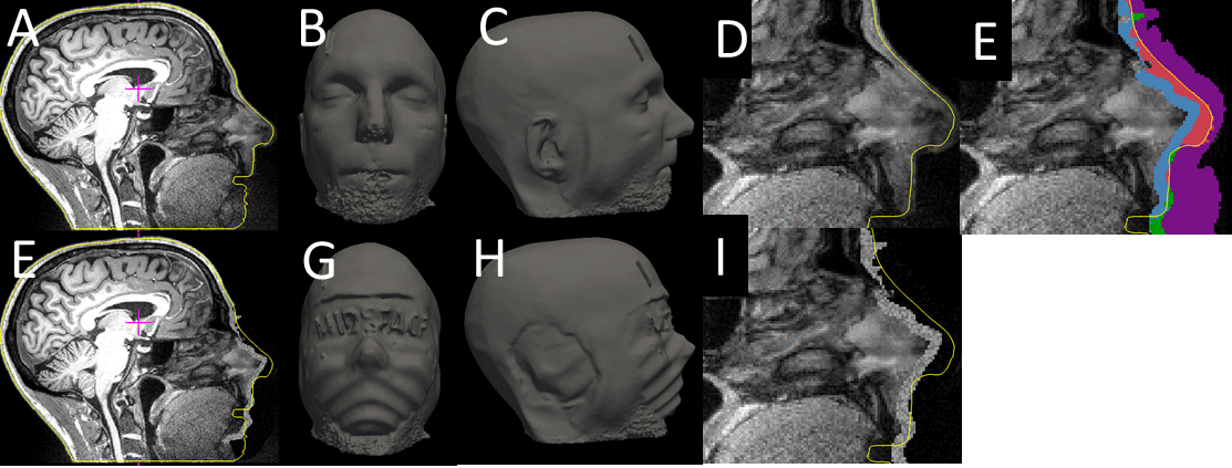 fig1.results.gif