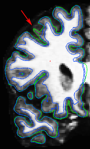 rh.Figure7.with_surfaces.with_arrows.png