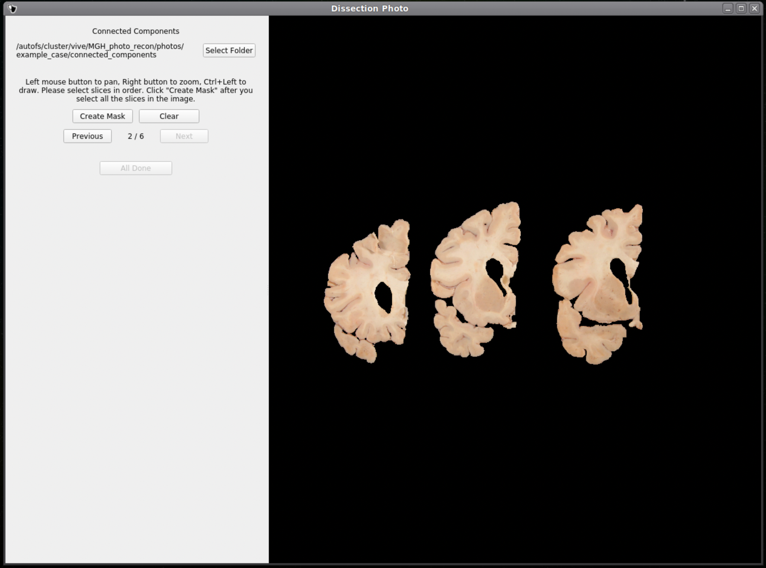 40_dissection_photo_gui_screen_4_tissue.png