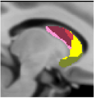 Choi2012_JNeurophysiol_17Network_striatum_sagittal_-12.png