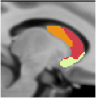 Choi2012_JNeurophysiol_7Network_striatum_sagittal_-12.png