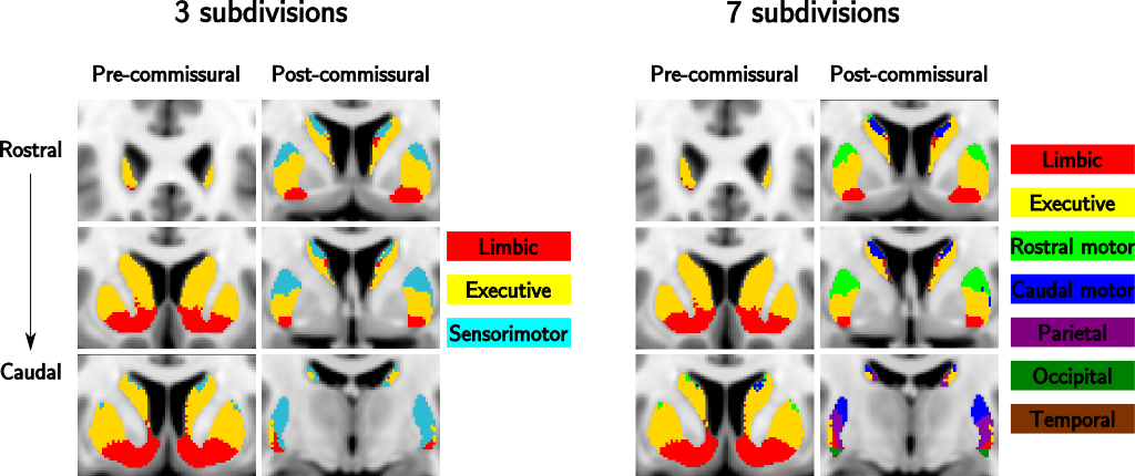 Figure 2. Striatum-con-label-thr50-7sub atlas